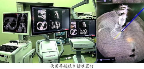 導航系統助兒童脊柱手術更精準 復旦兒科暑期手術刷新記錄